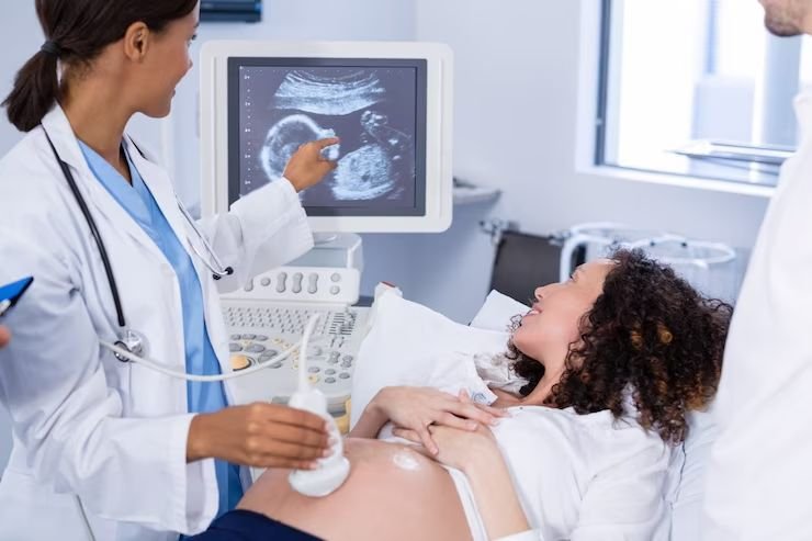 Echocardiography