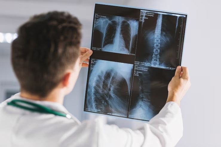 Digital X-Ray